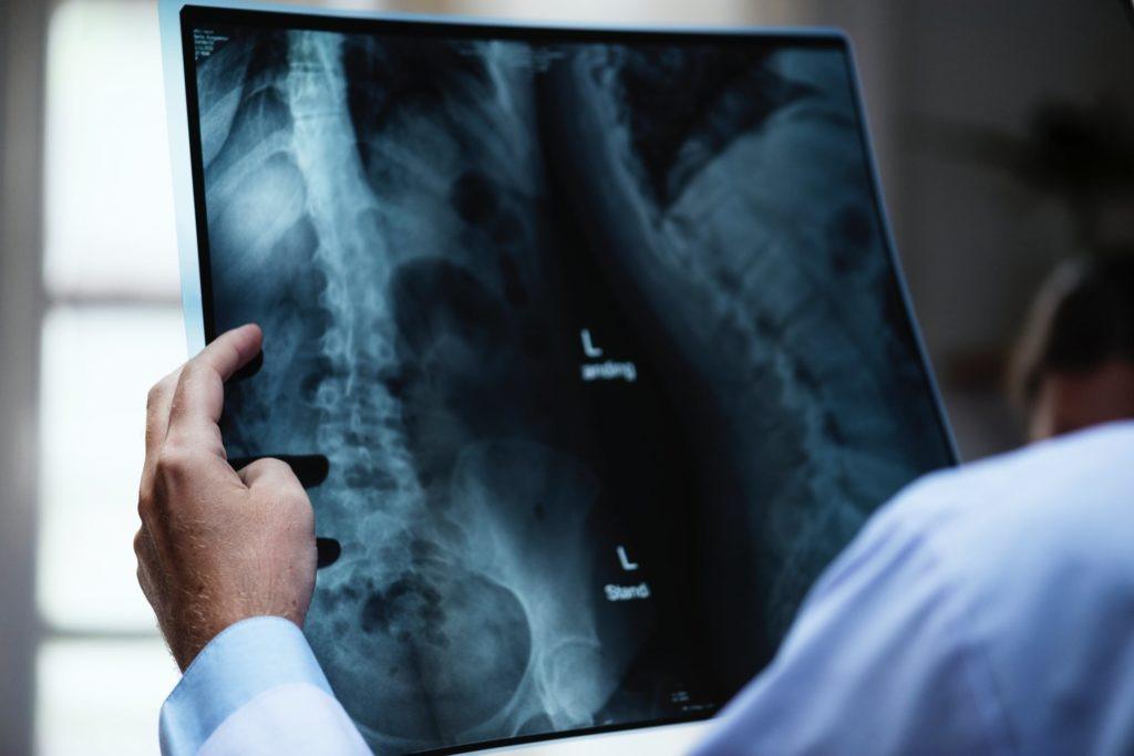 A pesquisa anunciou o importante desafio que os radiologistas enfrentam saúde pública e pessoal.Jorne Region Dow Wale