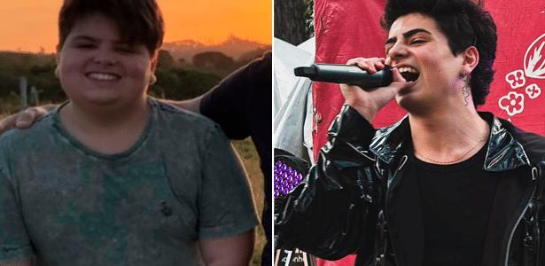 I had bariatric surgery when I was 13 because I was tired of being young