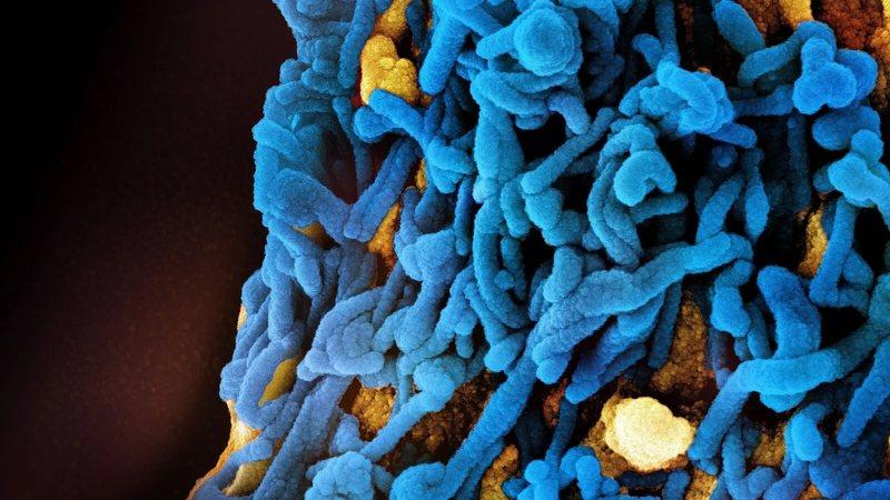 Um país africano confirmou um surto de um vírus mortal da família Ebola