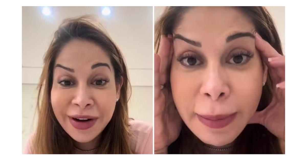 Botox errou e Maíra Cardi franziu a testa;o influenciador ficará feliz em quatro dias: ‘algo ridícul...